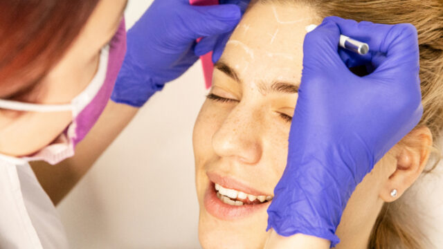 Cover-hijaluronski-fileri​